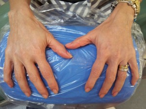 Cosmetic Dentistry Hand Rejuvenation After 1