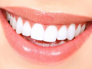 Unsafe Teeth Whitening