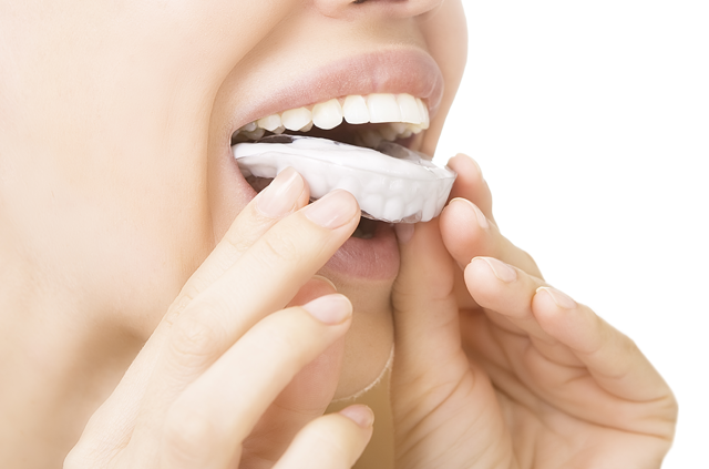 Teeth whitening last longer
