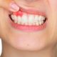 How to stop bleeding gums