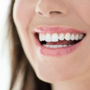 dental implants London