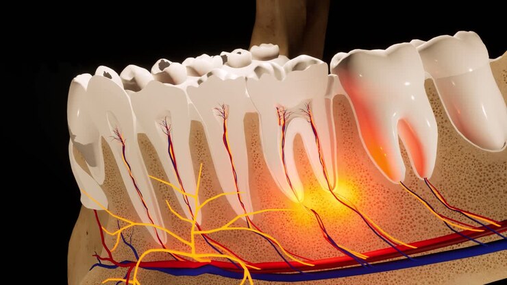 Marylebone Root Canal Treatment